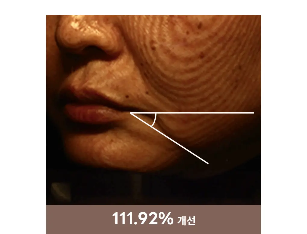 [탄력리프팅/1매] 메디힐 레티놀 콜라겐 윤곽 마스크 2종 (앰플/크림) 상세페이지 17